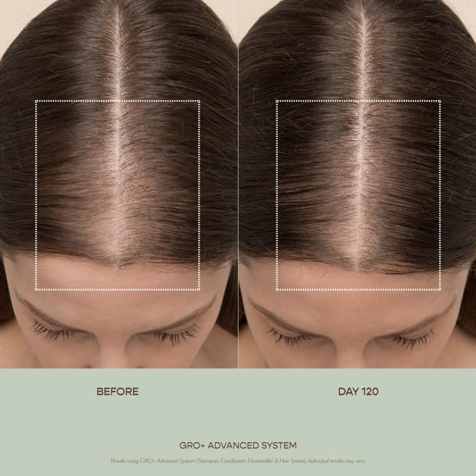 VEGAMOUR GRO+ Advanced Balancing Conditioner | Hydrates the Scalp, Nourishes and Softens Hair | For Severe Signs of Thinning | Color Safe, Vegan, Cruelty-Free, Formulated Without Silicones (8 Fl Oz) VEGAMOURBuy Supplements Australia
