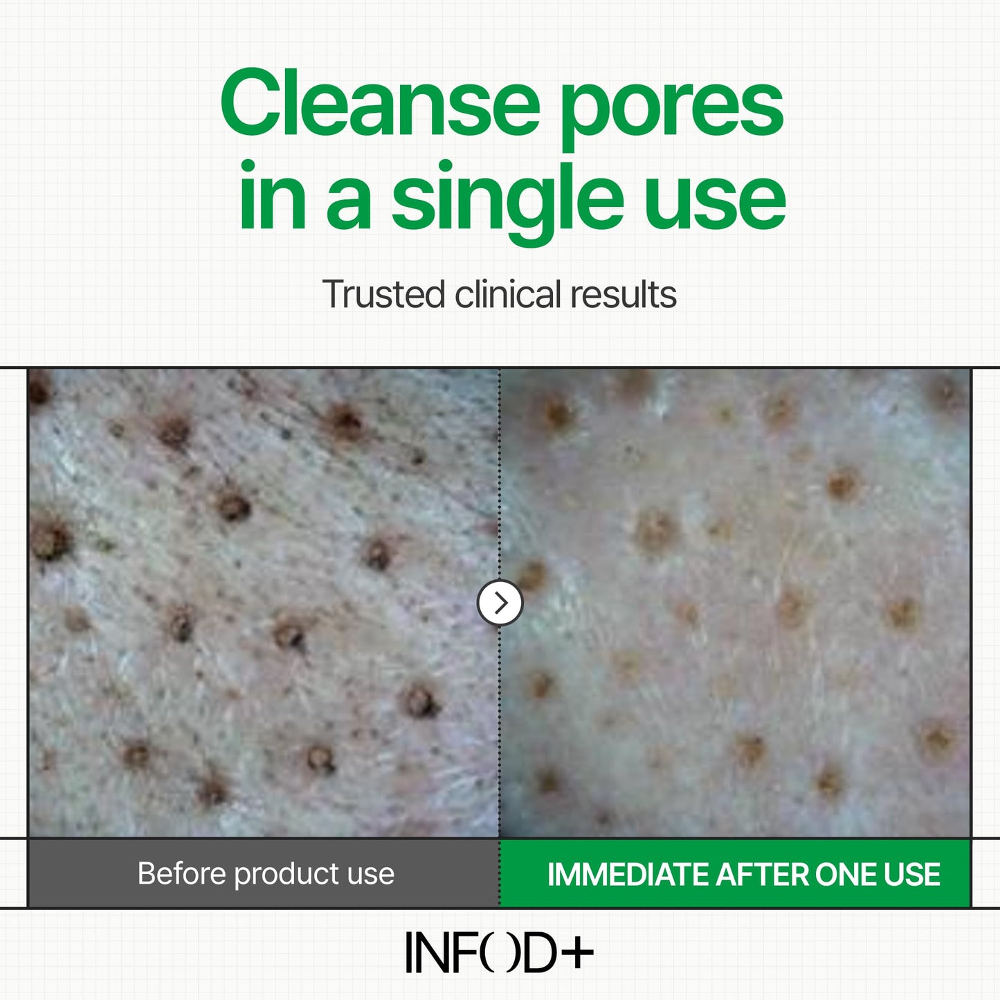 INFODPLUS Gel Cleanser, Gentle Low pH Deep Cleansing, Oil Control, Pore Blackhead Removal Face Wash, Ceramide Panthenol, Hydrating Barrier Balance Korean Skincare for Sensitive Skin, 3.38 fl.oz 100ml INFOD+ buy supplements Au