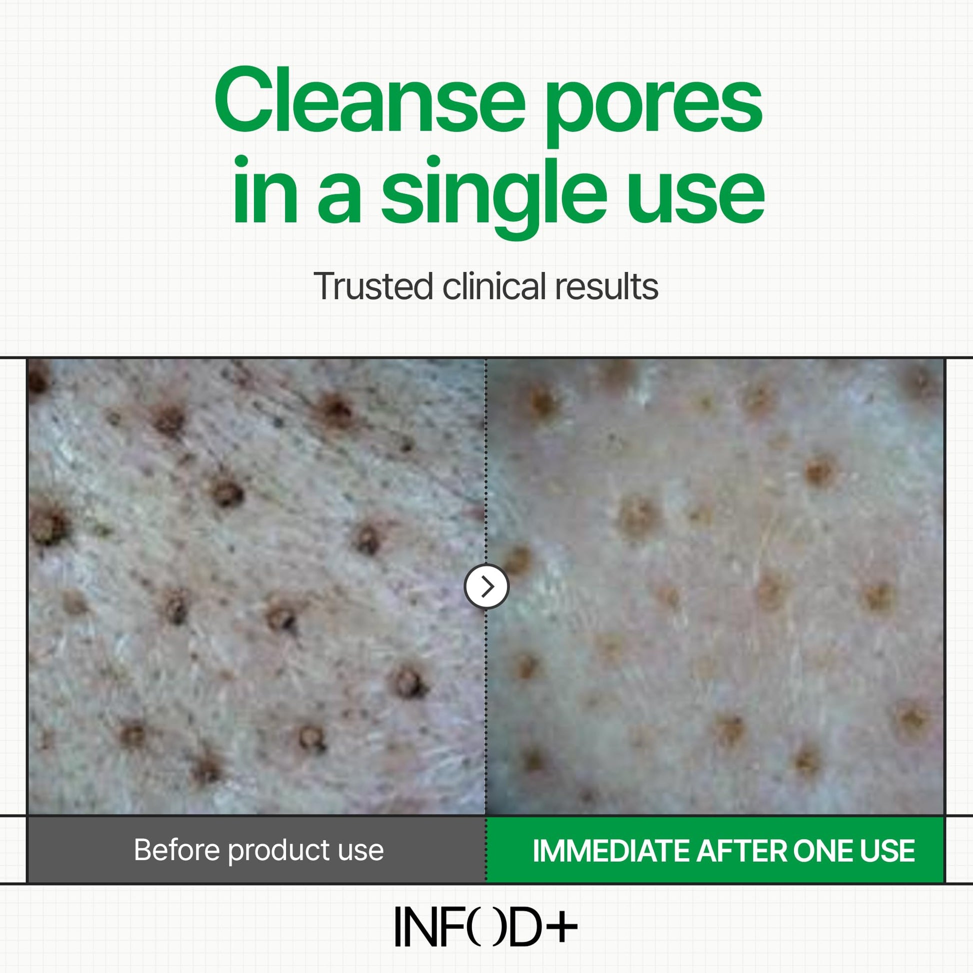 INFODPLUS Gel Cleanser, Gentle Low pH Deep Cleansing, Oil Control, Pore Blackhead Removal Face Wash, Ceramide Panthenol, Hydrating Barrier Balance Korean Skincare for Sensitive Skin, 3.38 fl.oz 100ml INFOD+ buy supplements Au