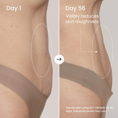 MAËLYS GET-DREAMY Overnight Toning Whip - Cellulite Cream & Skin Tightening Support with Milk Thistle + Uva-Ursi