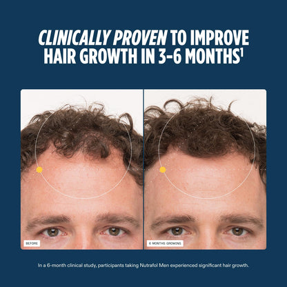 Nutrafol Men's Hair Growth Supplements, Clinically Tested for Visibly Thicker Hair and Scalp Coverage, Dermatologist Recommended - 1 Month Supply NutrafolBuy Supplements Australia
