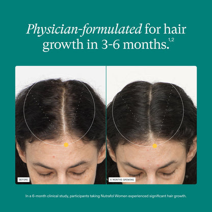 Nutrafol Women's Hair Growth Supplements, Ages 18-44, Clinically Proven for Visibly Thicker and Stronger Hair, Dermatologist Recommended - 1 Month Supply NutrafolBuy Supplements Australia