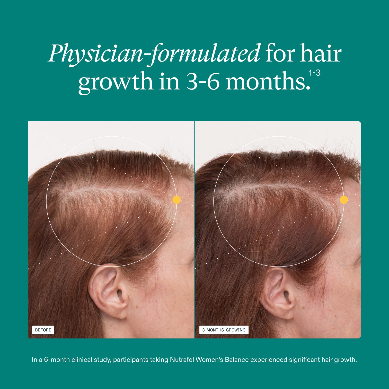 Nutrafol Women's Balance Hair Growth Supplements, Ages 45 and Up, Clinically Proven for Visibly Thicker Hair and Scalp Coverage, Dermatologist Recommended - 1 Month Supply NutrafolBuy Supplements Australia