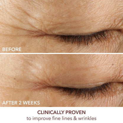 Advanced Retinol + Ferulic Triple Correction Eye Serum -15ml/0.5oz Dr Dennis Gross buy supplements Au