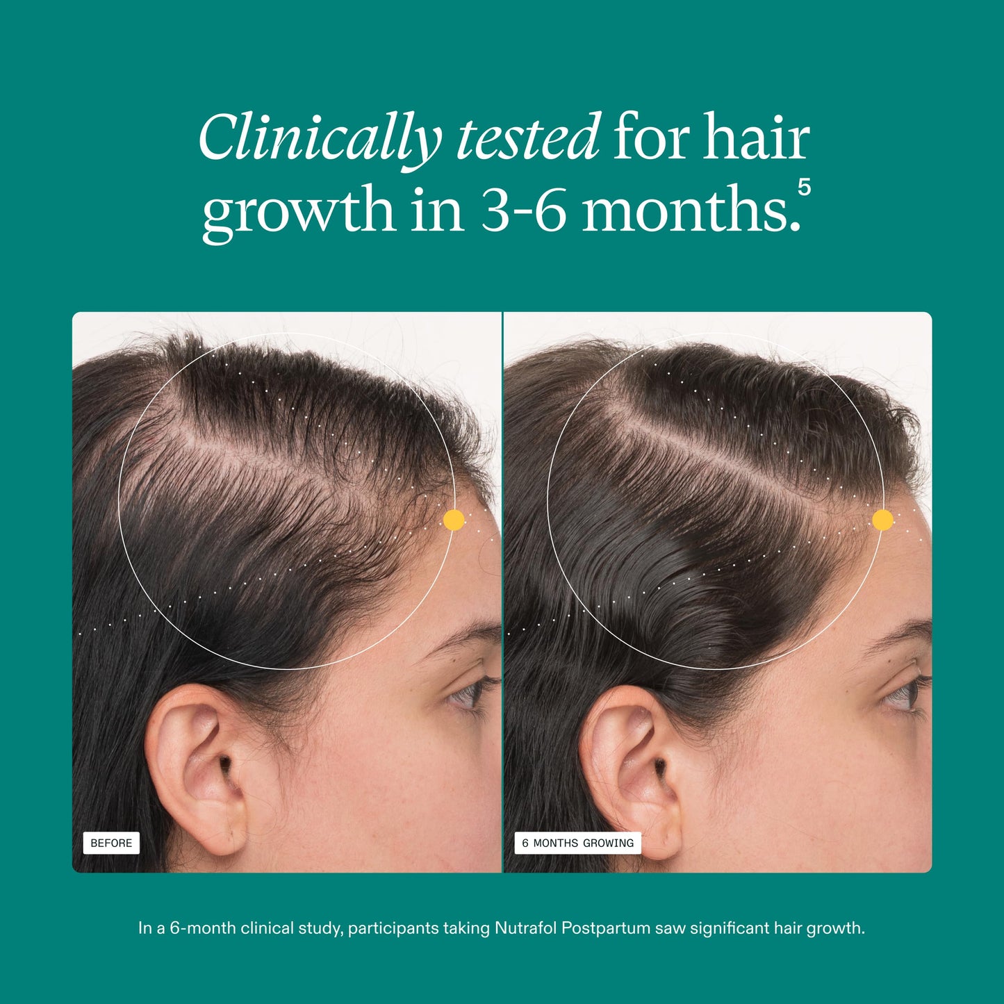 Nutrafol Postpartum Hair Growth Supplements, Clinically Tested for Visibly Thicker Hair and Less Shedding, Breastfeeding-friendly - 1 Month Supply NutrafolBuy Supplements Australia